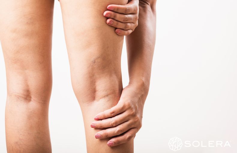 3.実は体重増加の正体は「脂肪」より「むくみ」